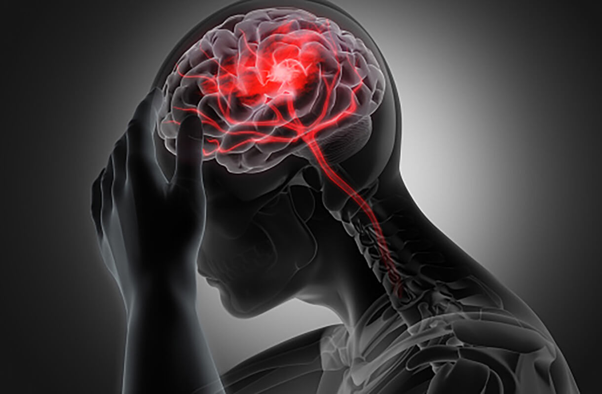 brain injuries and car accidents brain injuries and car accidents